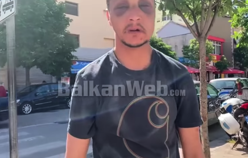 Moroccan Migrant Claims Albanian Police Tortured and Beat Him