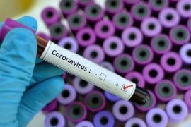 Si bëhet analiza e koronavirusit?