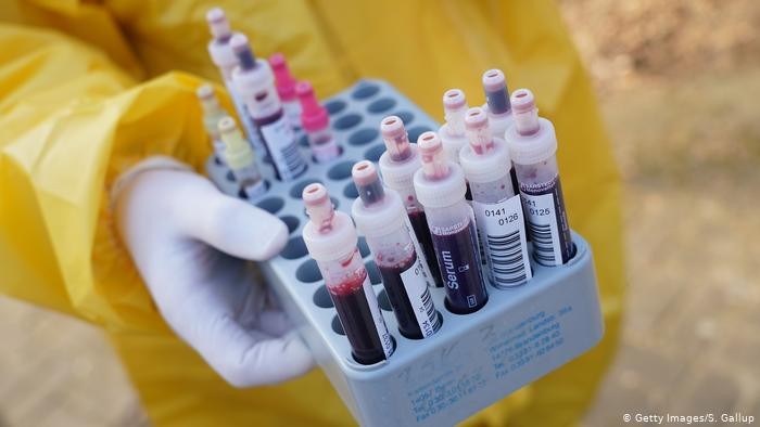 CDC amerikane përjashton nga testimi personat pa simptoma
