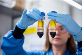 Shkencëtarët në Britani testojnë përzierjen e vaksinave AstraZeneca e Pfizer